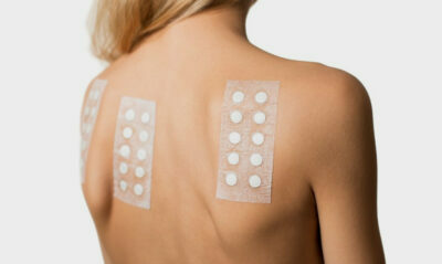 dematologisk patch test